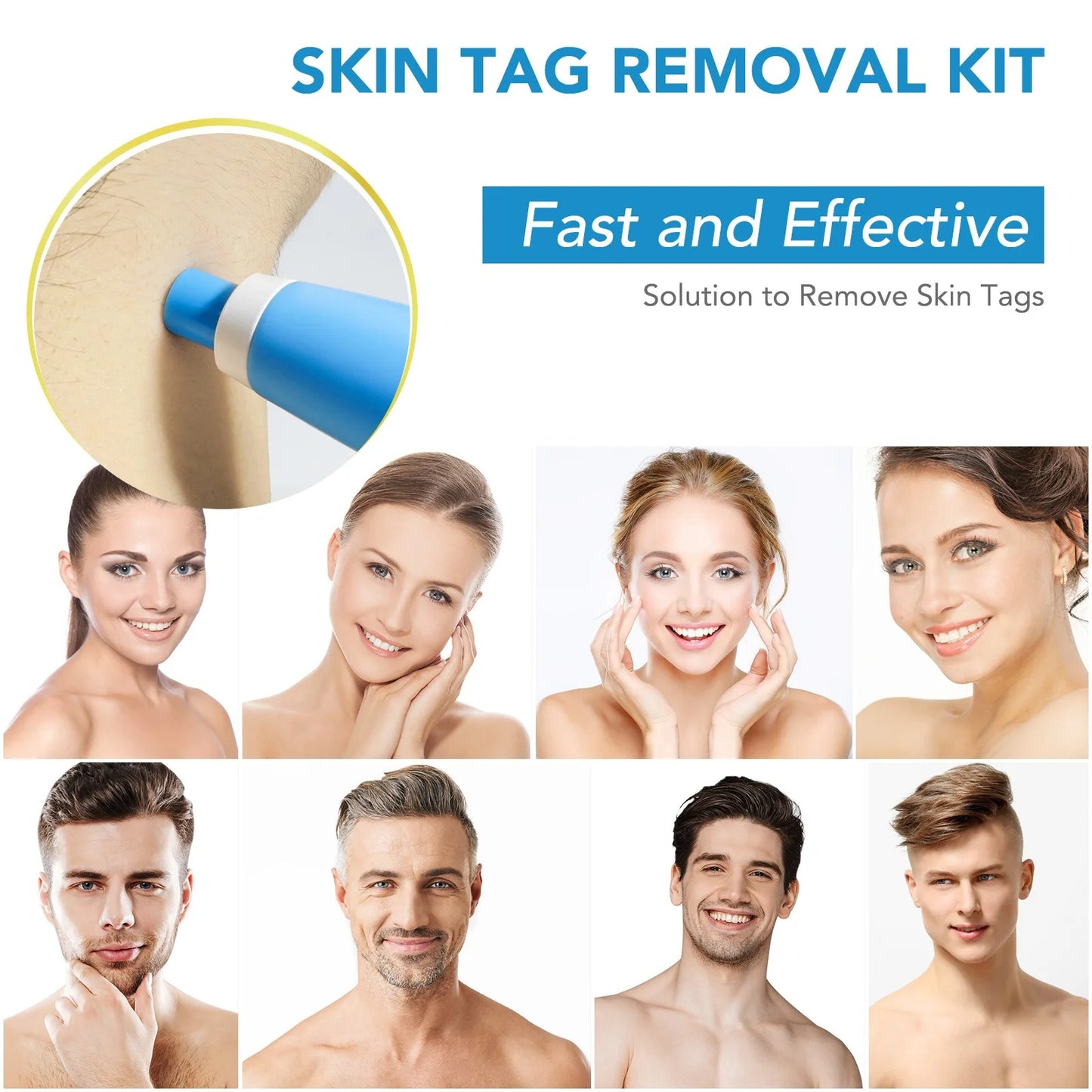 SKIN TAG - KILLER KIT