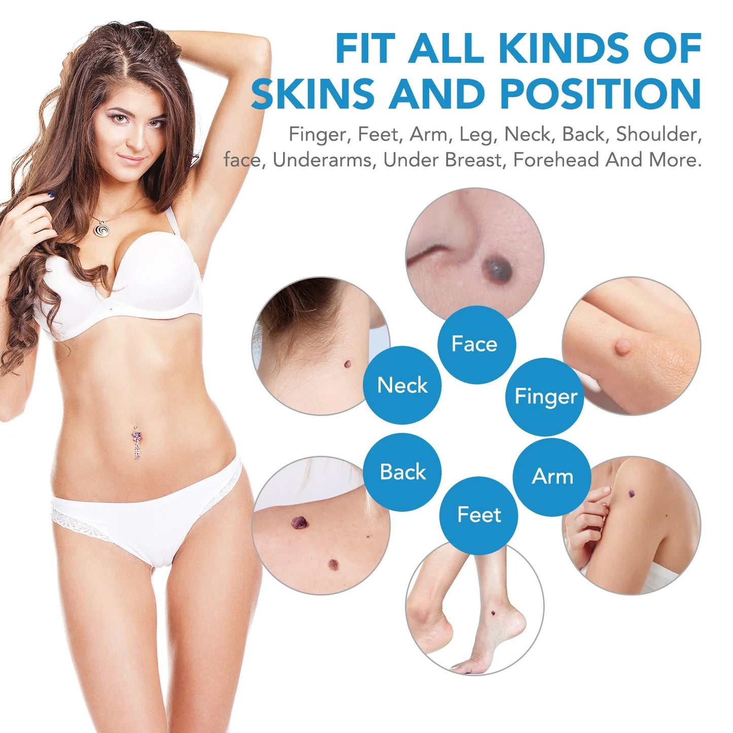 SKIN TAG - KILLER KIT