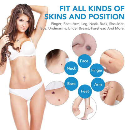 SKIN TAG - KILLER KIT