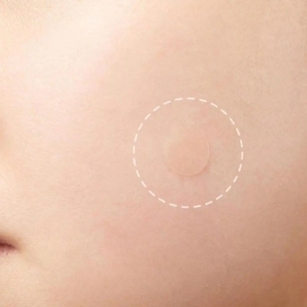 HEALING ACNE PATCH